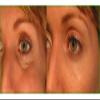 Elavont Miracle Eye Serum view 3