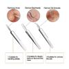 Blackhead Remover Kit - FEITA Blackhead Tweezers Removal Tool Kit Set - Acne Tweezers Pimple Comedone Extractor with Travel Case (5 Pcs) view 4