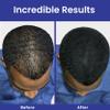INFINITY Hair Fibers Dark Brown for Thinning Hair for Women & Men - 100% Undetectable Hair Building Fiber Powder - Conceal Hair Loss in 15 Seconds, 60g view 4