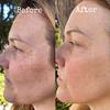 Anti-Aging Travel Kit view 3