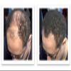Caboki Hair Loss Concealer, All-Natural Hair Building Fiber. Make Thin Hair Look 10X Fuller Instantly. Eliminate the Appearance of Bald Spot and Thinning Hair (30G, 90-Day Supply). Black view 3