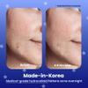 AVARELLE Spot Pimple Patches for Face | Good Night Acne Cover | Hydrocolloid with Tea Tree Oil | Acne Spot Treatment (12-14 mm, 24 ct) view 2