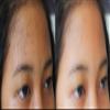 Vitality Precision Skin RX Salicylic Peel Pads view 2