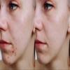 Vitality Precision Skin Microdermabrasion Scrub view 3