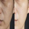Vitality Precision Skin Microdermabrasion Scrub view 4