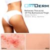 Butt & thigh Acne Treatment Pads - Exfoliating Pads to Eliminate Acne Causing Bacteria. Removes Pimples, Blemishes & Ingrown Hairs for the Buttocks & Thigh Area for Both Men & Women. view 3
