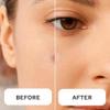 LE GUSHE Korean Pimple Patches for Face (132 Dots) - Hydrocolloid Acne Patches with Tea Tree Oil - Invisible Zit Stickers - Dermatologist Tested - Korean Skin Care view 4