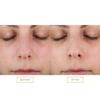 Clarisonic Sonic Face Exfoliator Cleansing Brush Head | Gentle Exfoliating Brush to Brighten Skin | Suitable for Sensitive Skin view 4