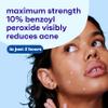 Clean & Clear Persa-Gel 10 Acne Spot Treatment, 1 fl. oz view 2