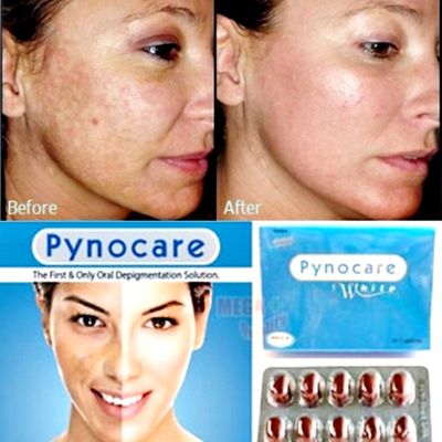 4 PACK(80 CAPSULES) OF PYNOCARE 100% HERBAL WHITENIN ANTI MELASMA HYPERPIGMENTATION SUN DAMAGE DARK SPOT