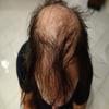 Hair Building Fibers Black 25 Grams Refill Your Existing Bottle. Highest Grade Fiber By Finally Hair (Black) view 3
