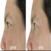 AntiAging Peel Pads-20% Glycolic Cell Renewal Peel Pads+ Salicylic, Lactic Acid, Argireline, DMAE view 4
