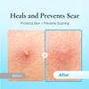 DERMAKR Discreet Acne Pimple Patch | Spot Cover & Treatment Solution Cystic Acne & Pimple | Hydrocolloid Facial Stickers | Waterproof Patches Invisibly Cover Pimples (4packs) view 4