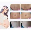 3pcs Scars Removal Cream, Mango Remove Pregnancy Scars Cream Stretches Marks Treatment Maternity Repair Firming Skin view 4