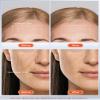 NEWKEY LED Face Mask Light Therapy,Red Light Therapy for Face Wrinkle Blue Light Therapy Mask for Face Acne,150LEDs,10 Min Auto Shut off, Wired view 3