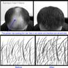 Samson Hair Building Fibers Hair Loss Concealer MEDIUM BROWN large REFILL 50gr Made in USA Available Worldwide view 4