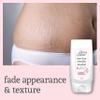 YUMMY MUMMY AFTER BIRTH GET RID OF STRETCH MARKS FADE APPEARANCE & TEXTURE by Yummy Mummy view 2