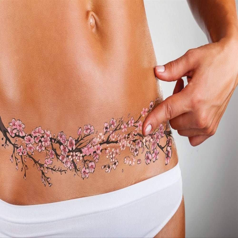 TuckTats: Sayura Cherry Blossom Temporary Tattoo - Tummy Tuck or Mastectomy Scar Cover, Realistic and Long Lasting, Fashionable and Safe