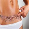 TuckTats: Sayura Cherry Blossom Temporary Tattoo - Tummy Tuck or Mastectomy Scar Cover, Realistic and Long Lasting, Fashionable and Safe view 1