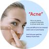 (0BQY0733) Acne Removal Rejuvenation Moisturizing Mask view 2