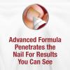 Kerasal Kerasal Nail Fungal Nail Renewal Treatment 10ml (2 Pack), 2 Count view 4
