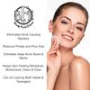 Acne Treatment Pads- Eliminates Cystic Breakouts, Oily Skin & Clogged Pores. Clear Pimple, Whitehead, Blackhead, Dark Spots & Improve Skin Texture. view 4