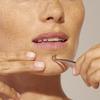 Tweezerman Stainless Steel Blackhead Extractor, Silver view 3