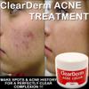 Acne Treatment Cream by CLEAR DERM view 2