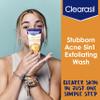 Clearasil Stubborn Acne Control 5in1 Exfoliating Wash, Maximum Strenght with 2% Salicylic Acid Acne Treatment Medicine, Daily Acne Facial Cleanser 6.78 fl oz view 4