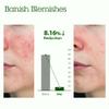 BLITHE Patting Splash Mask Face Exfoliator with Soothing & Healing Green Tea - Lactic Acid Exfoliating Face Wash for Acne Prone Skin, Vegan K Beauty Oil Controlling & Pore Clarifying 5.07 Fl Oz view 3
