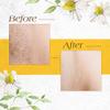 GiGi Waxing Strips for Hair Waxing/Hair Removal, Petite & Small Muslin Strips, 100 Strips each, 2 Pack view 3