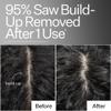 ACT+ ACRE Cold Processed Scalp Detox Oil - Sulfate-Free Care for Flaky, Dry and Itchy Scalp - Promotes Thicker, Fuller-Looking Hair view 3