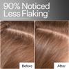 ACT+ ACRE Cold Processed Scalp Detox Oil - Sulfate-Free Care for Flaky, Dry and Itchy Scalp - Promotes Thicker, Fuller-Looking Hair view 4