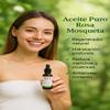 100% Certified Organic Growing Rosehip Oil/Aceite Puro De Rosa Mosqueta 30 Ml. / 1 Fl.oz.heals Dry Skin, Fine Lines, Acne Scars, Eczema, Psoriasis, Dermatitis, Sun Damage & More view 4