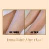 Bee Stunning DIAMONDBUFF Microderm Exfoliation Tool - At Home Professional BODY Diamond Crystal Microdermabrasion for Glowing Youthful Skin - Soften Crepey Skin, Fine Lines, & Improve Rough Texture! view 3