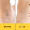 GiGi Microwave Wax Kit - All Purpose Honee Soft Wax Hair Removal Kit for Face & Body, Includes Wax, Strips, and Applicators, Easy At-Home Waxing, 1 Set view 3