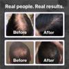 Shapiro MD Hair Growth Experts Hair Loss Shampoo | DHT Fighting Vegan Formula for Thinning Hair Developed by Dermatologists | Experience Healthier, Fuller and Thicker Looking Hair | 2 Month Supply view 4