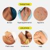 Fur Silk Scrub: Premium KP Bump Eraser - Powerful Exfoliating & Resurfacing Scrub to Smooth and Hydrate Skin While Preventing Ingrown Hairs with Natural Oils and AHAs - 6 Fl oz. view 3