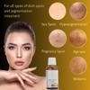 Luxury Swiss Dark Spot Remover for Face Body Serum Gel Cream Age Sun Brown anti Spot Acne Freckles Corrector Melasma treatment Anti aging Skin Vitamin C + Niacinamide best organic brand Magiclear view 2