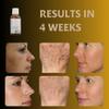 Luxury Swiss Dark Spot Remover for Face Body Serum Gel Cream Age Sun Brown anti Spot Acne Freckles Corrector Melasma treatment Anti aging Skin Vitamin C + Niacinamide best organic brand Magiclear view 3