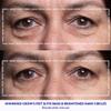 Wrinkles Schminkles Under Eye Wrinkle Patches | Smooth Eye Wrinkles, Crows Feet & Dark Circles Overnight | 6 Pairs Reusable Medical Grade Silicone Patches view 3