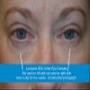 Lycopene Skin Care  Under Eye Complex - With Miracle Haloxyl for Fighting Dark Circles & Puffy Eyes Naturally view 4