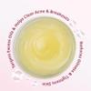 ACNE CLEANSER (4oz) Blemish Astringent Skin Care Oily Clogged Pores Blackheads Pimples Face Cleaner view 2