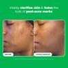 Paula's Choice BOOST 10% Azelaic Acid Booster Cream Gel Face Serum with Salicylic Acid, Oil-Free Skin Brightening Serum for Face, Fragrance-Free, 1oz view 4