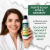Acne Zap - Shampoo for Scalp Acne  Clear Scalp from Acne, Zits and Pimples 6.0 oz view 4