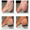 Aquareveal Gentle Action Water Peel for Body , exfoliator for feet, elbows, knees, hands, keratosis pilaris ,5 Fl Oz view 2
