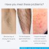 Hair Growth Inhibitor, Hair Removal Spray Reducing And Inhibiting Hair Growth, Legs, Underarms,Lips 100% Natural Non-Irritating view 2