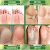PurOrganica Urea 20% Healing Cream 4 oz - Best Callus Remover - Moisturizes and Rehydrates Hands, Feet and Knees to a Healthy Appearance - Soothes and Softens Thick, Cracked, Rough Dead and Dry Skin view 4