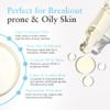 Salicylic 10% Gel Peel, Breakout and Pore Minimizer and Cleanser, 15-30 Full Facial Chemical Peels, 1 fl oz. e, 30 mL  Perfect Image view 3