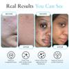 Salicylic 10% Gel Peel, Breakout and Pore Minimizer and Cleanser, 15-30 Full Facial Chemical Peels, 1 fl oz. e, 30 mL  Perfect Image view 4